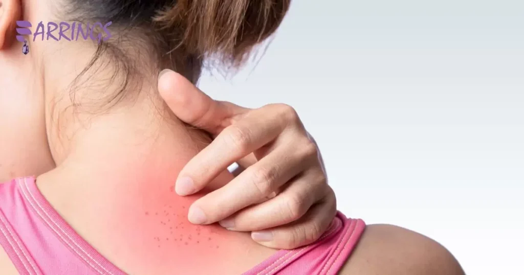 Conditions That Cause Itchy Skin