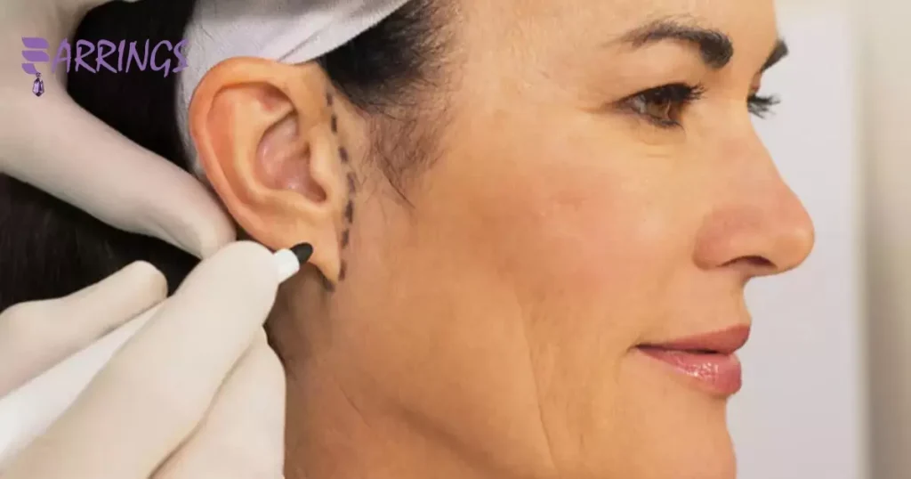 Ear Hole Repair Without Surgery