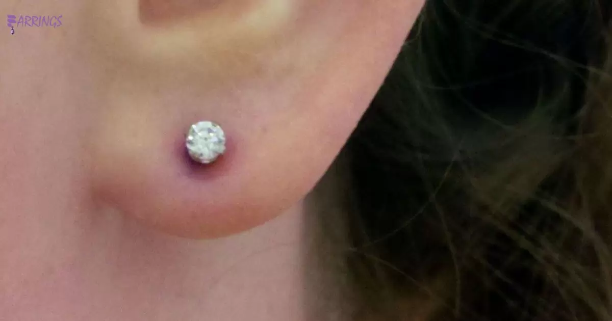 Do Plastic Earrings Cause Infection?