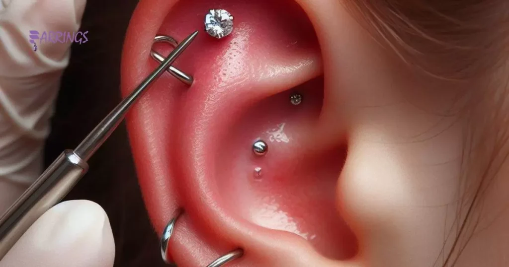 Upper Ear Lobe Piercing Healing Time